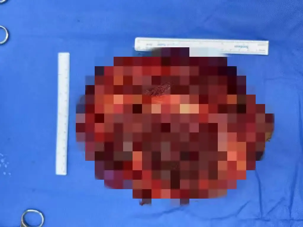 5BBF9